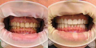 dental-studio-m-emax
