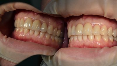 dental-studio-m-emax