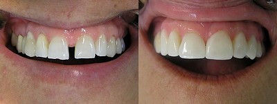 dental-studio-m-emax