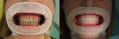 dental-studio-m-emax