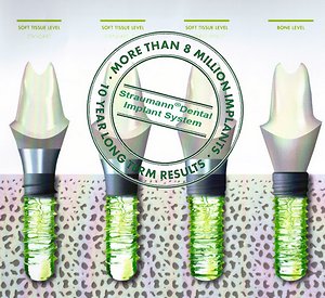 dental-studio-m-straumann-implants